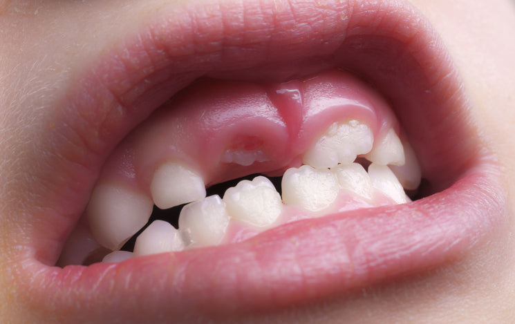Researchers Have Discovered That Our DNA Contains the Ability to Regrow Teeth - It Just Needs to be "Switched on"